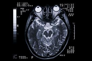 足立区で便利に眼科受診！信頼できる眼科医師と出会える眼の健康管理術